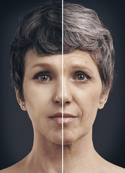 agingskin